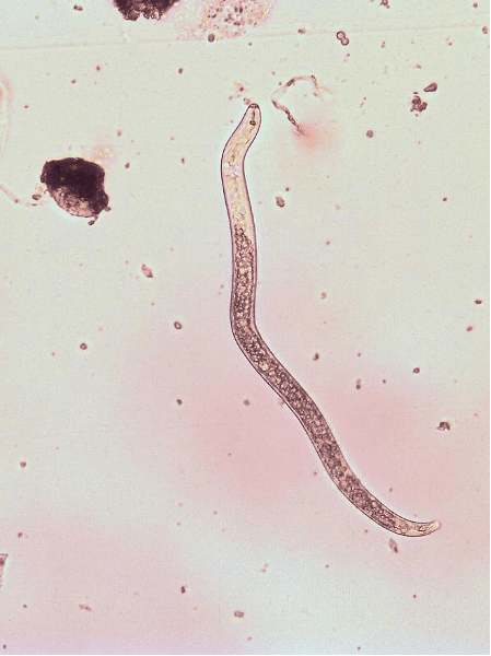 Lesion Nematode